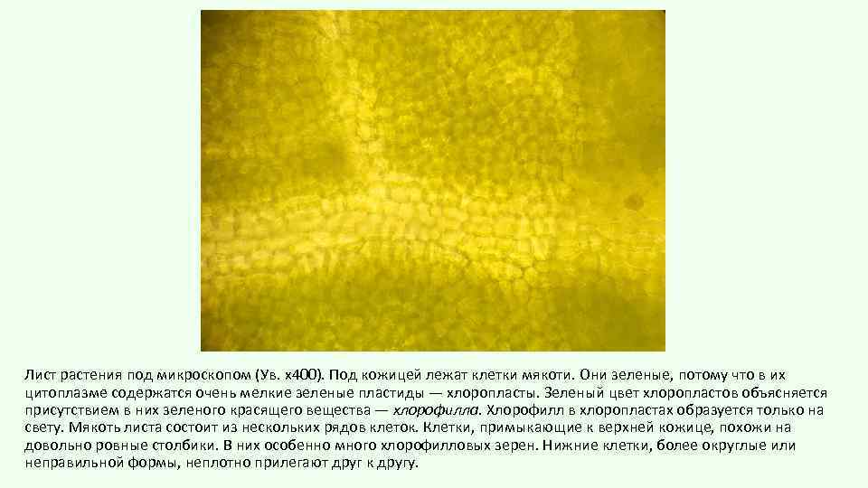 Лист растения под микроскопом (Ув. х400). Под кожицей лежат клетки мякоти. Они зеленые, потому