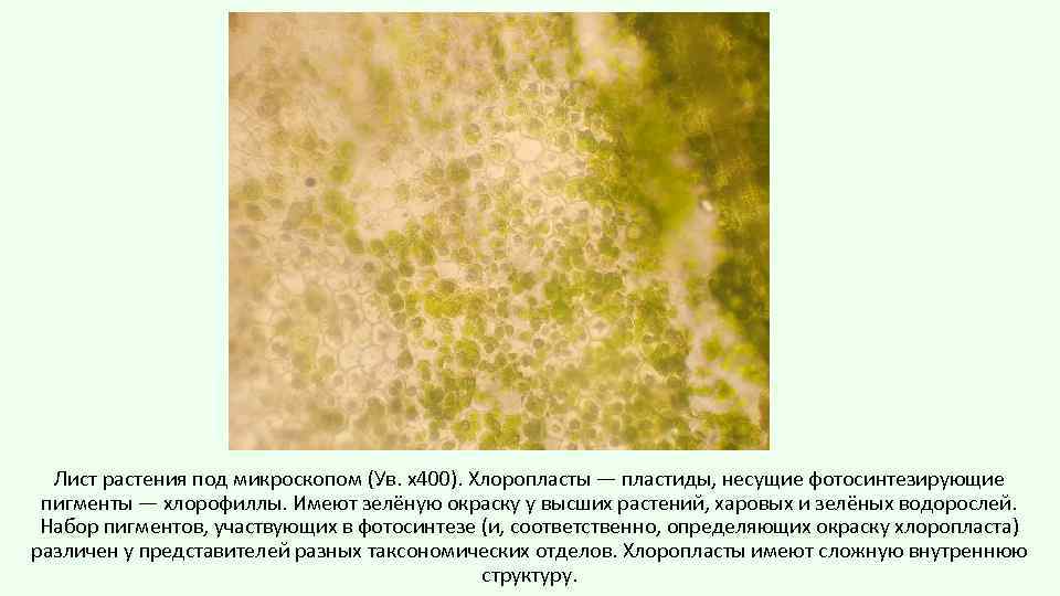 Лист растения под микроскопом (Ув. х400). Хлоропласты — пластиды, несущие фотосинтезирующие пигменты — хлорофиллы.