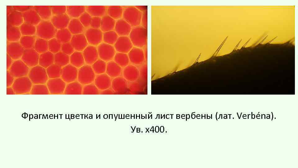 Фрагмент цветка и опушенный лист вербены (лат. Verbéna). Ув. х400. 