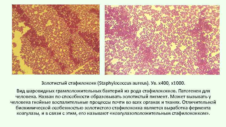 Золотистый стафилококк презентация микробиология