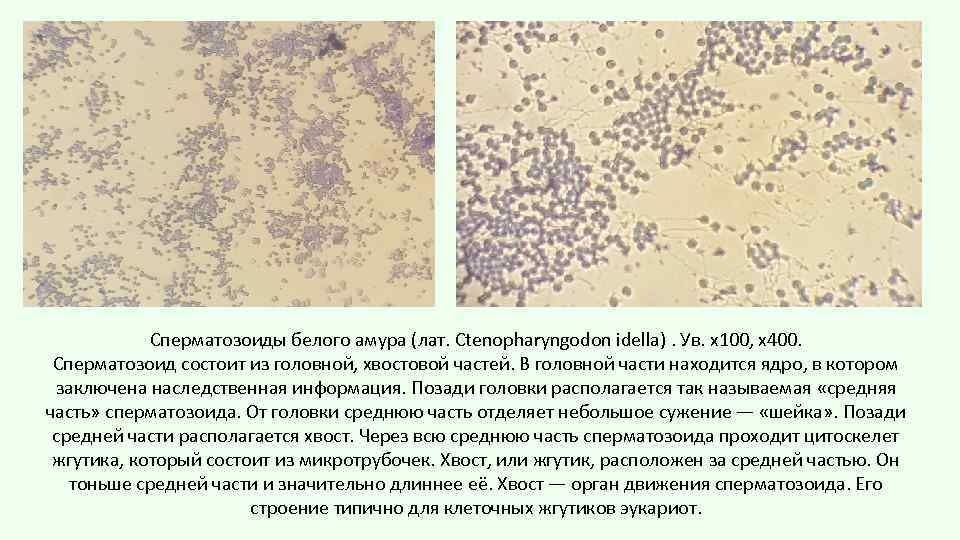 Сперматозоиды белого амура (лат. Ctenopharyngodon idella). Ув. х100, х400. Сперматозоид состоит из головной, хвостовой