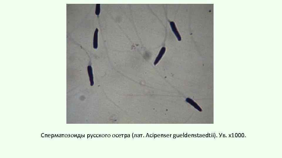 Сперматозоиды русского осетра (лат. Acipenser gueldenstaedtii). Ув. х1000. 