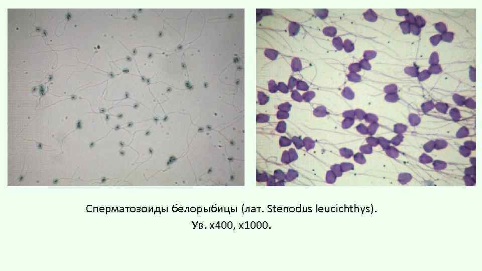 Сперматозоиды белорыбицы (лат. Stenodus leucichthys). Ув. х400, х1000. 