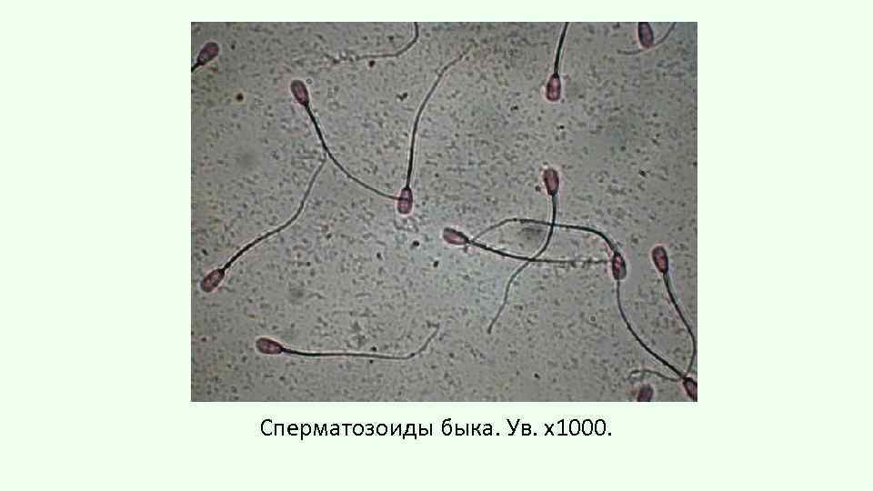 Сперматозоиды быка. Ув. х1000. 