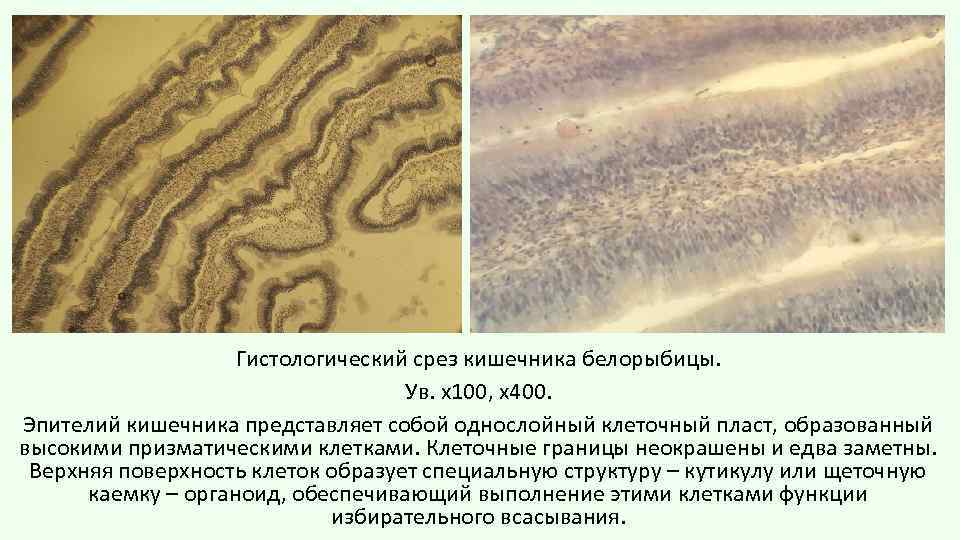 Гистологический срез кишечника белорыбицы. Ув. х100, х400. Эпителий кишечника представляет собой однослойный клеточный пласт,