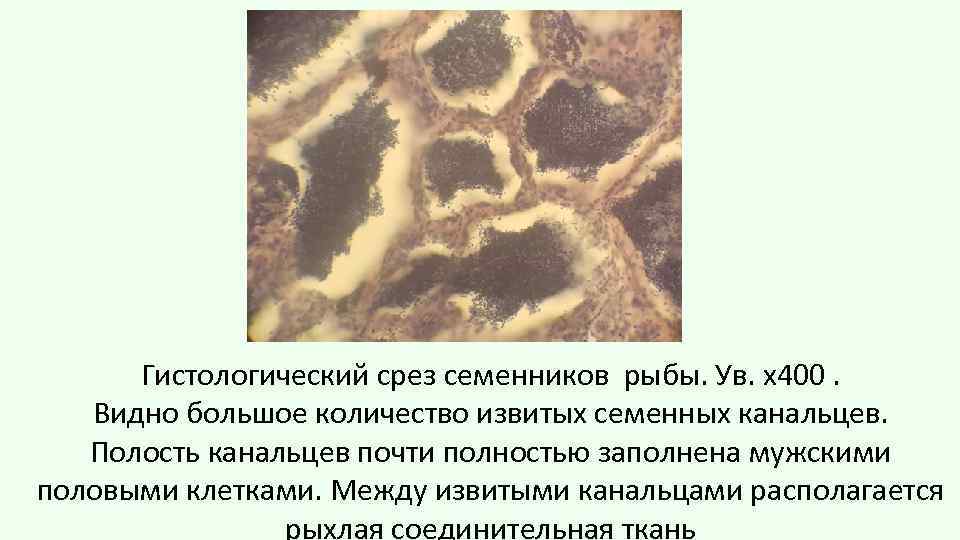 Гистологический срез семенников рыбы. Ув. х400. Видно большое количество извитых семенных канальцев. Полость канальцев
