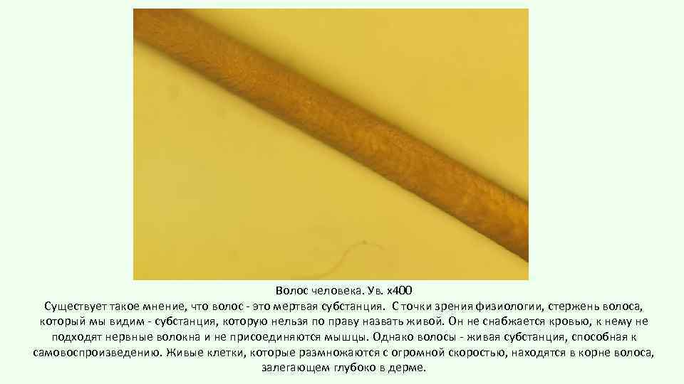 Волос человека. Ув. х400 Существует такое мнение, что волос - это мертвая субстанция. С