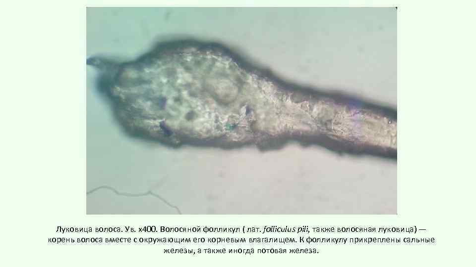 Луковица волоса. Ув. х400. Волосяной фолликул ( лат. folliculus pili, также волосяная луковица) —