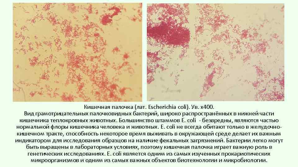Кишечная палочка (лат. Escherichia coli). Ув. х400. Вид грамотрицательных палочковидных бактерий, широко распространённых в