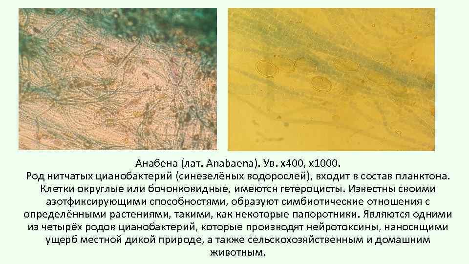 Анабена (лат. Anabaena). Ув. х400, х1000. Род нитчатых цианобактерий (синезелёных водорослей), входит в состав