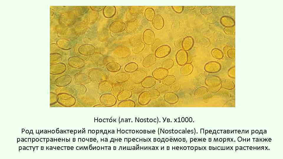 Носто к (лат. Nostoc). Ув. х1000. Род цианобактерий порядка Ностоковые (Nostocales). Представители рода распространены