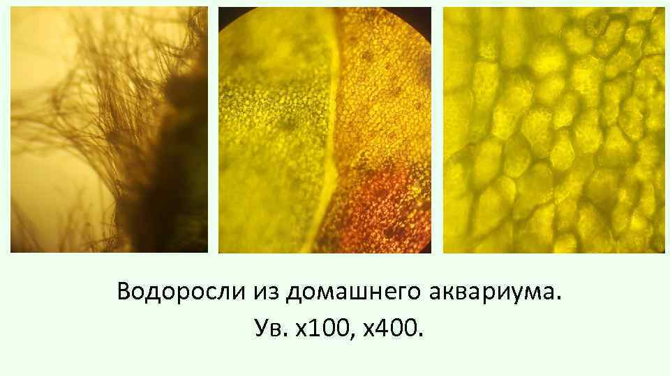 Водоросли из домашнего аквариума. Ув. х100, х400. 