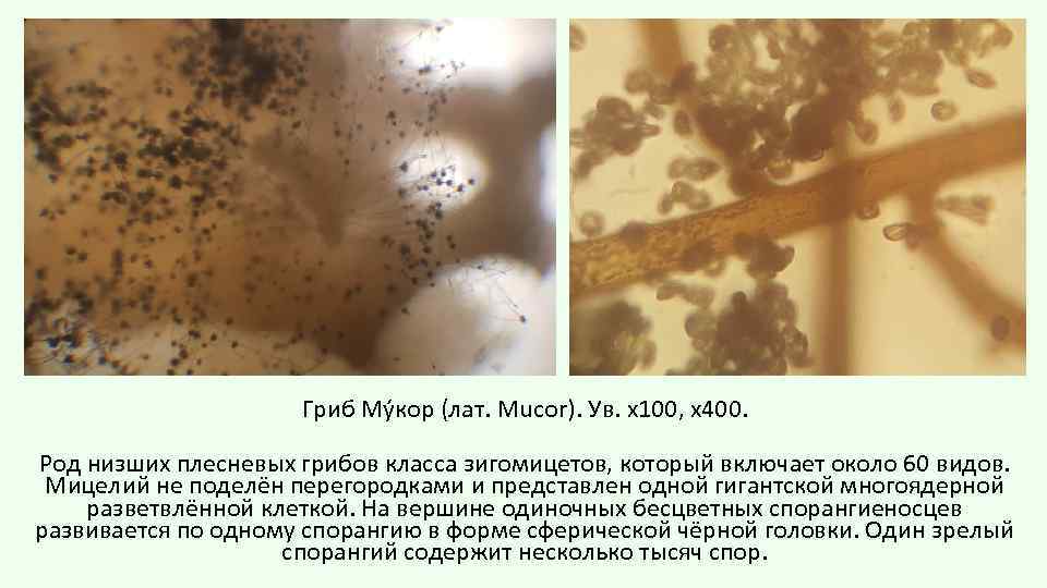 Гриб Му кор (лат. Mucor). Ув. х100, х400. Род низших плесневых грибов класса зигомицетов,