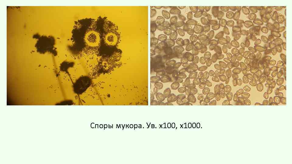 Споры мукора. Ув. х100, х1000. 