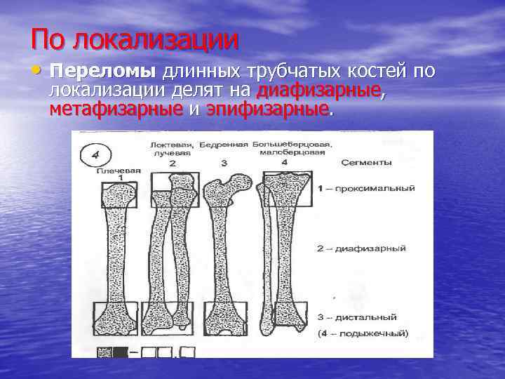 По локализации • Переломы длинных трубчатых костей по локализации делят на диафизарные, метафизарные и