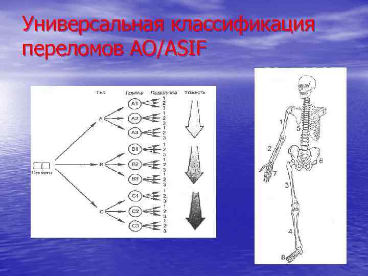 Универсальная классификация переломов АО/ASIF 
