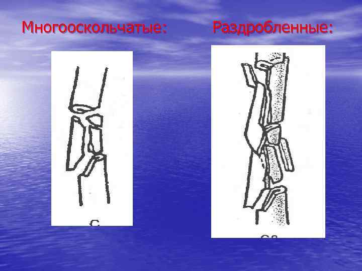 Многооскольчатые: Раздробленные: 