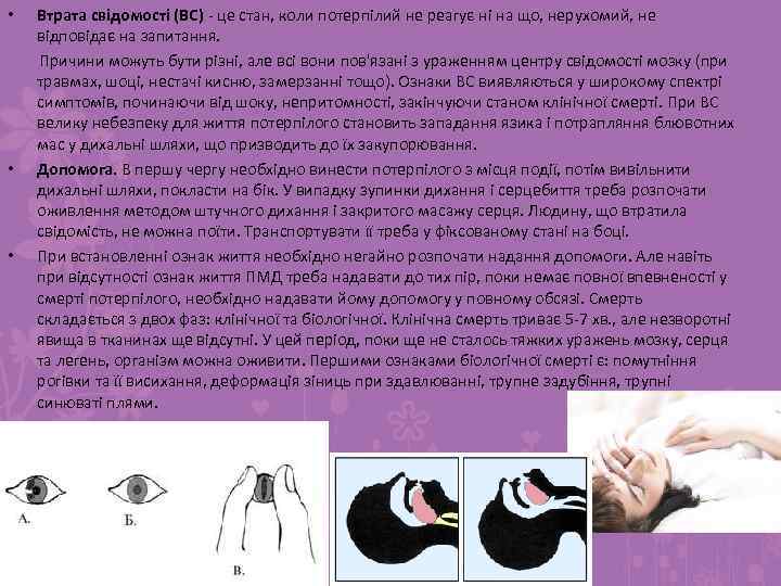 Втрата свідомості (ВС) - це стан, коли потерпілий не реагує ні на що, нерухомий,
