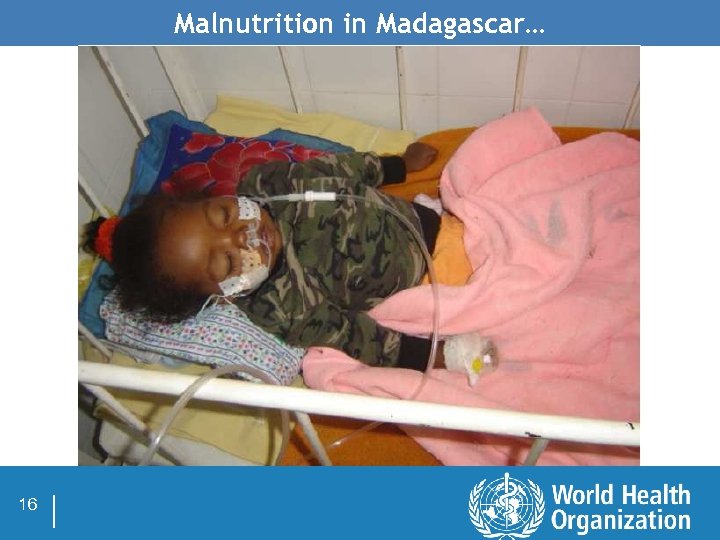 Malnutrition in Madagascar… 16 