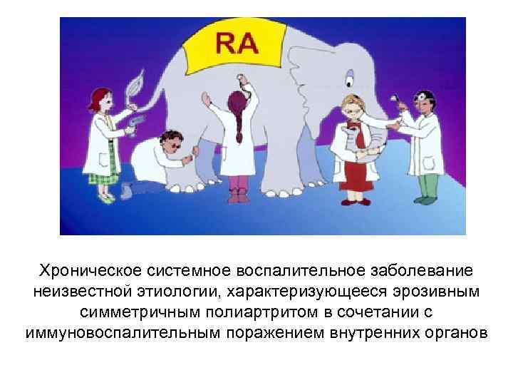 Хроническое системное воспалительное заболевание неизвестной этиологии, характеризующееся эрозивным симметричным полиартритом в сочетании с иммуновоспалительным