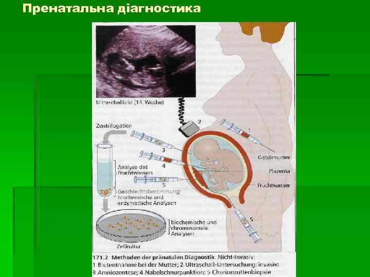 Пренатальна діагностика 