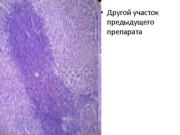  • Другой участок предыдущего препарата 