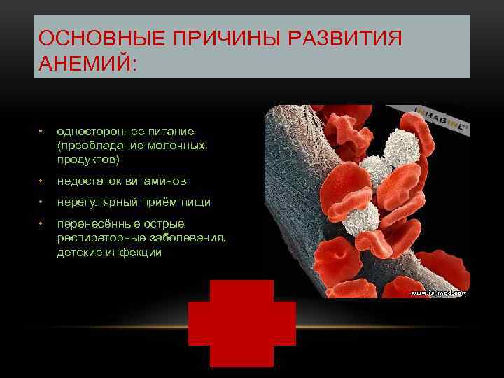 ОСНОВНЫЕ ПРИЧИНЫ РАЗВИТИЯ АНЕМИЙ: • одностороннее питание (преобладание молочных продуктов) • недостаток витаминов •