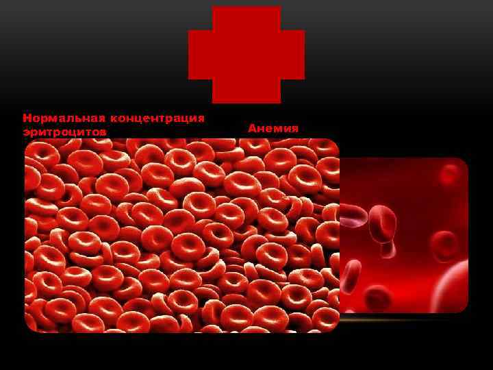 Нормальная концентрация эритроцитов Анемия 