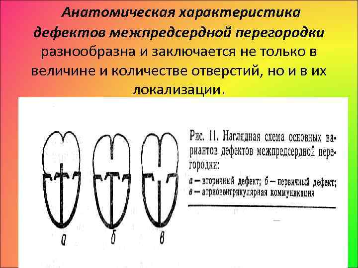 Анатомическая характеристика дефектов межпредсердной перегородки разнообразна и заключается не только в величине и количестве