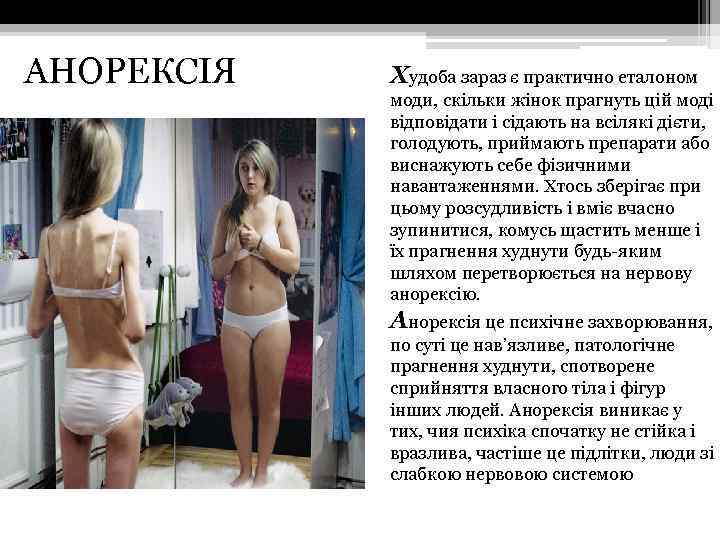 АНОРЕКСІЯ Худоба зараз є практично еталоном моди, скільки жінок прагнуть цій моді відповідати і