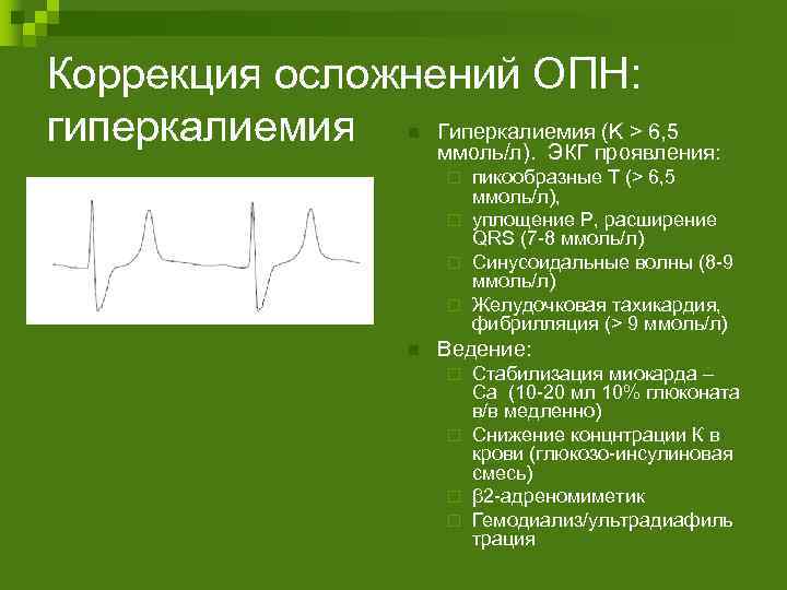 Гиперкалиемия на экг