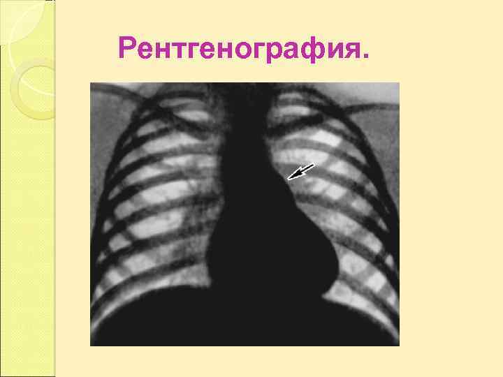 Рентгенография. 