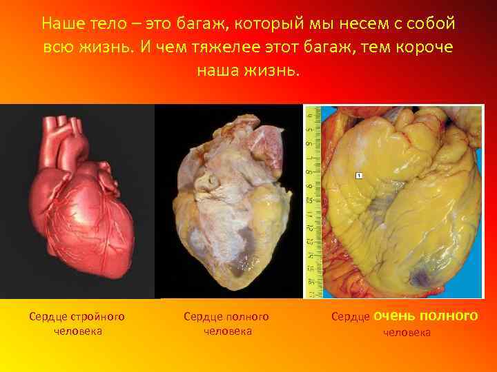Наше тело – это багаж, который мы несем с собой всю жизнь. И чем