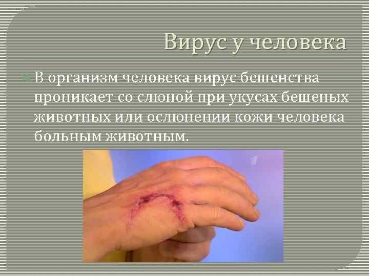 Вирус у человека В организм человека вирус бешенства проникает со слюной при укусах бешеных