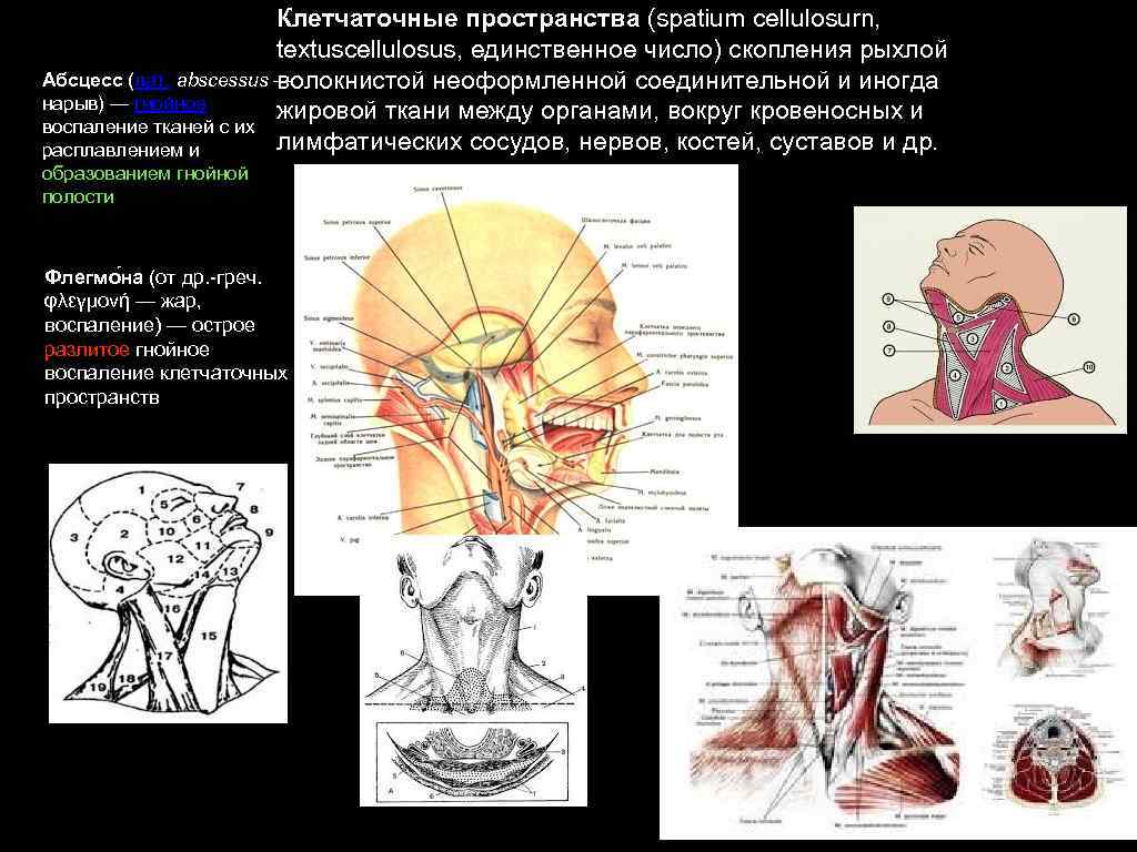 Клетчаточные пространства (spatium cellulosurn, textuscellulosus, единственное число) скопления рыхлой Абсцесс (лат. abscessus — волокнистой