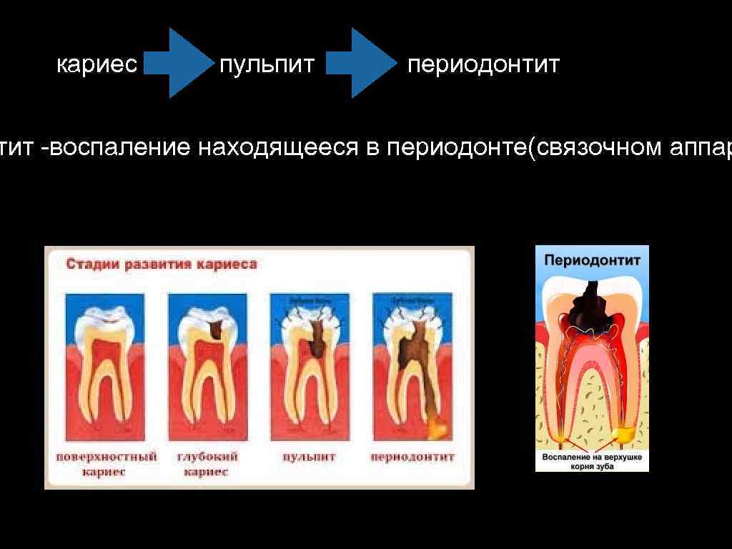 Характерной особенностью клинической картины ангины людвига является