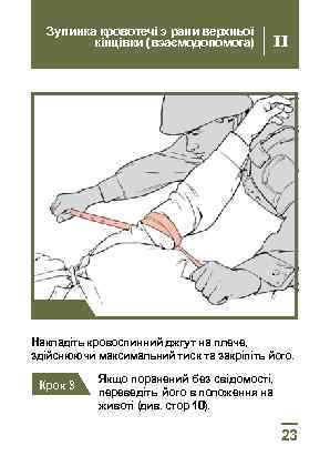 Зупинка кровотечі з рани верхньої кінцівки (взаємодопомога) II Крок 2 Накладіть кровоспинний джгут на