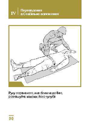 IV Переведення в Стабільне положення Крок 1 Руку пораненого, яка ближче до Вас, розташуйте