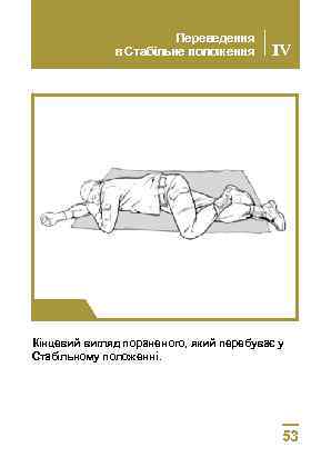 Переведення в Cтабільне положення IV Крок 4 Кінцевий вигляд пораненого, який перебуває у Стабільному