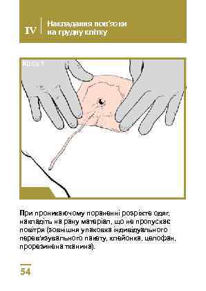 IV Накладання пов’язки на грудну клітку Крок 1 При проникаючому пораненні розріжте одяг, накладіть