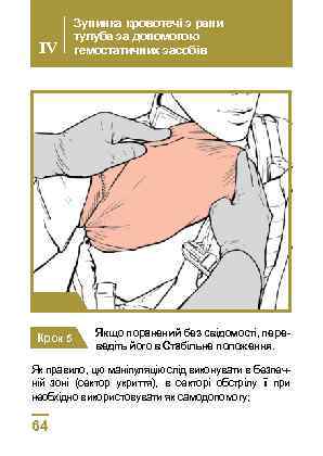 IV Зупинка кровотечі з рани тулуба за допомогою гемостатичних засобів Крок 4 Крок 5