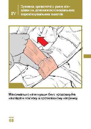 IV Зупинка кровотечі з рани кінцівки за допомогою спеціальних перев’язувальних пакетів Крок 3 Максимально
