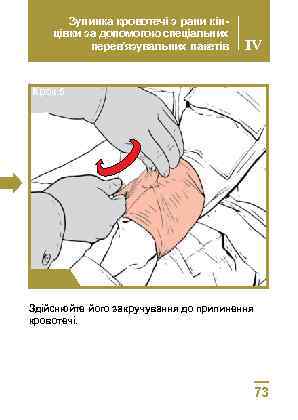 Зупинка кровотечі з рани кінцівки за допомогою спеціальних перев’язувальних пакетів IV Крок 5 Здійснюйте