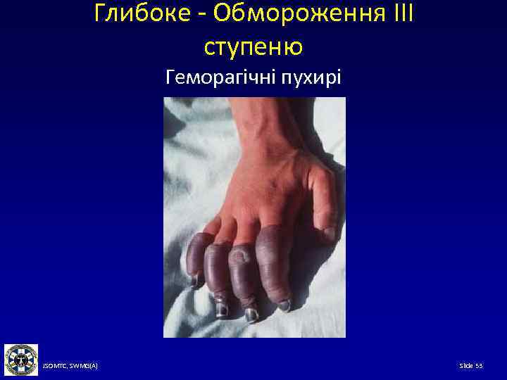 Глибоке - Обмороження III ступеню Геморагічні пухирі JSOMTC, SWMG(A) Slide 53 