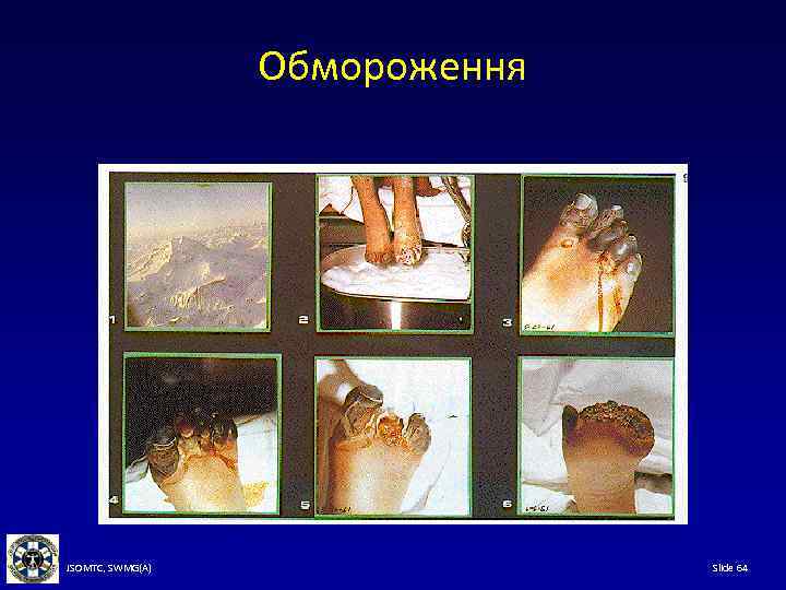 Обмороження JSOMTC, SWMG(A) Slide 64 