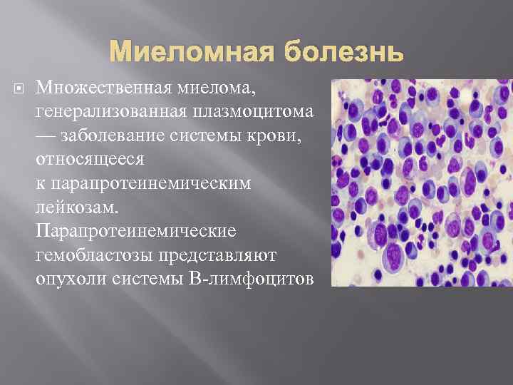 Парапротеинемические гемобластозы презентация