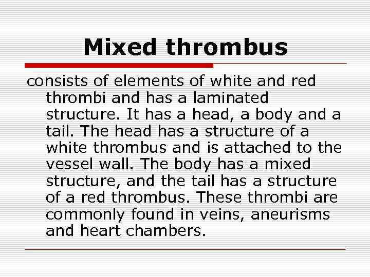 Mixed thrombus consists of elements of white and red thrombi and has a laminated