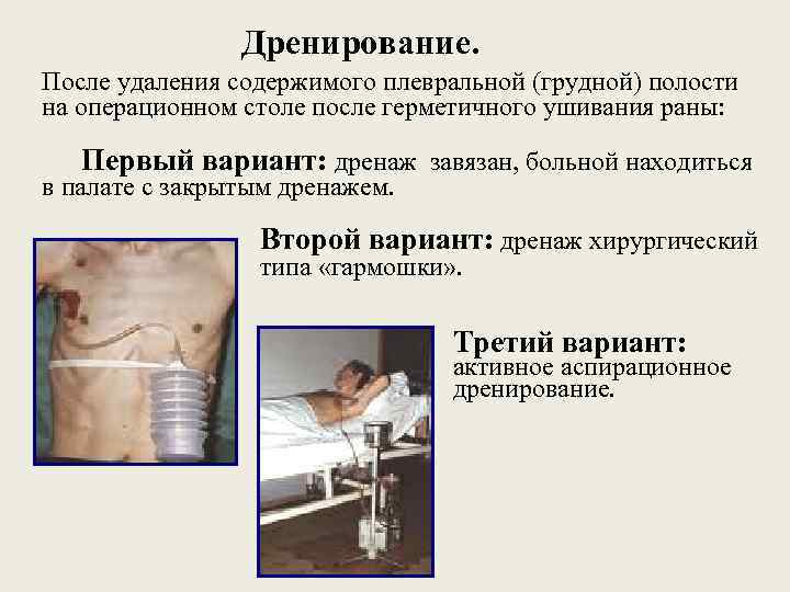 Дренирование. После удаления содержимого плевральной (грудной) полости на операционном столе после герметичного ушивания раны: