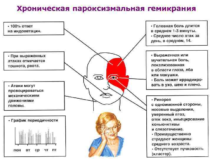 Хроническая пароксизмальная гемикрания 