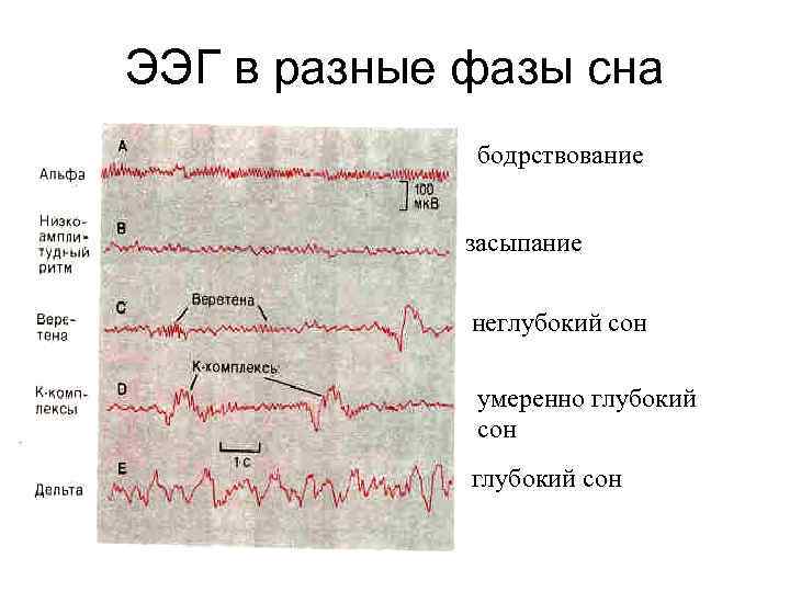 ЭЭГ в разные фазы сна бодрствование засыпание неглубокий сон умеренно глубокий сон 